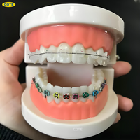 Ligature orthodontique dentaire colorée attache des bandes de caoutchouc élastiques pour supports matériel orthodontique