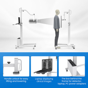 휴대용 의료 엑스레이 방사선 촬영기 이동식 디지털 엑스레이 장비 경량 이동식 가슴 엑스레이 프레임 - Product Image 2
