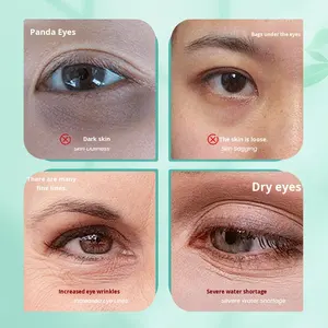 Masque pour les <span class=keywords><strong>yeux</strong></span> en <span class=keywords><strong>gel</strong></span> matriciel solide, hydratant, réducteur de ridules, à base de collagène et d'acide hyaluronique, vente en gros OEM - Product Image 3