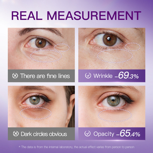 Masque pour les yeux lyophilisé <span class=keywords><strong>anti</strong></span>-rides au collagène et au venin de serpent BIOAQUA, marque privée, gel hydratant pour les yeux, patchs sous les yeux - Product Image 6