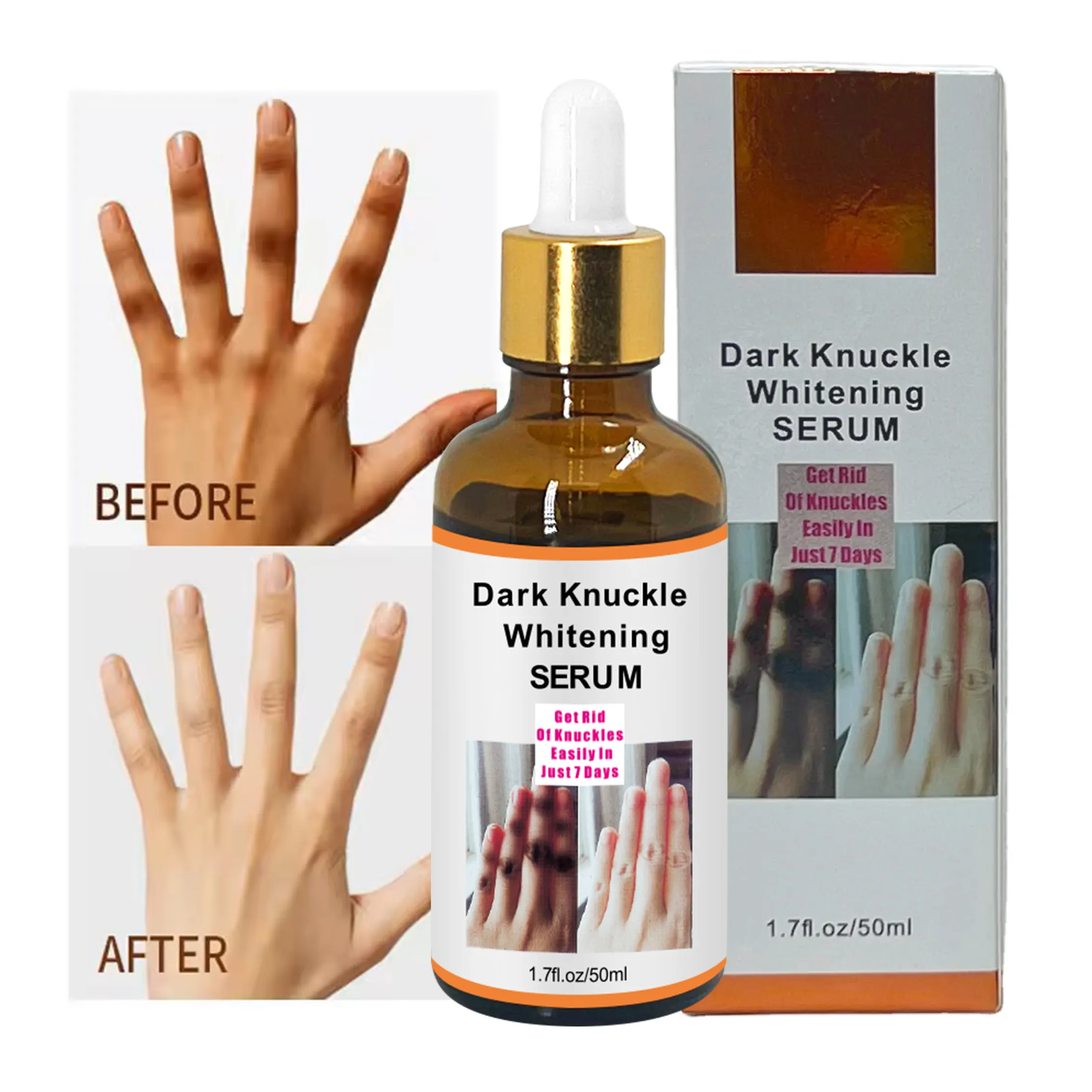 Label pribadi Serum pemutih Knuckles cepat, korektor pigmentasi tangan sendi siku lutut hitam gelap, minyak penghilang sendi kaki