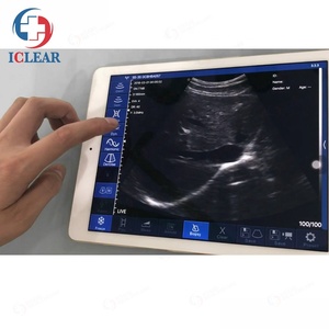 Alat Pemindai <span class=keywords><strong>Ultrasound</strong></span> Mini Nirkabel Portabel untuk <span class=keywords><strong>Laptop</strong></span> untuk Hewan - Product Image 6