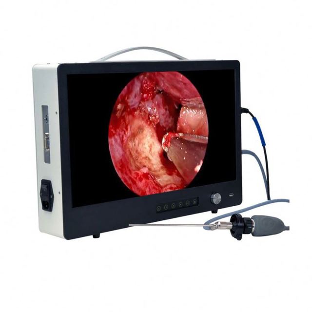 Medical ENT Endoscopy 1080P Full HD Digital Portable USB All-in-one Endoscope Camera System