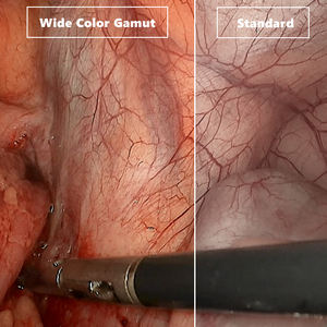 Système de caméra endoscopique 4K UHD <span class=keywords><strong>IKEDA</strong></span> <span class=keywords><strong>Medical</strong></span> pour tour de laparoscopie et ORL - Product Image 4