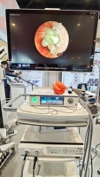 Système de caméra d'endoscopie chirurgicale FHD avec source de lumière LED 100W, ensemble complet pour laparoscopie, examen ORL et chirurgie de la colonne vertébrale