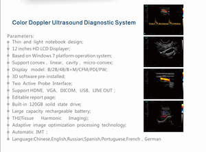 Escáner de Ultrasonido Portátil para <span class=keywords><strong>Centro</strong></span> de Diagnóstico por Imágenes Médicas, Equipo de Ultrasonido para Uso <span class=keywords><strong>Veterinario</strong></span> o Humano - Product Image 6