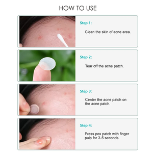 Parches Transparentes de Hidrocoloide para Acné y Espinillas de 10mm y 12mm, Resistentes al Agua, con Etiqueta OEM, para Todo Tipo de <span class=keywords><strong>Piel</strong></span> - Product Image 6