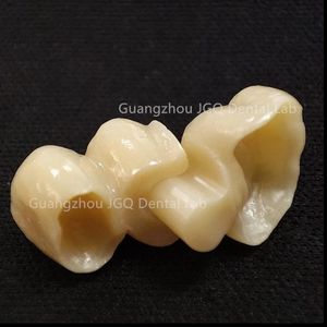 Dentaduras postizas totalmente cerámicas Zirconia o dentaduras postizas Pfm Tipos de Diseño Digital en <span class=keywords><strong>Exocad</strong></span> Rápido y eficiente - Product Image 3