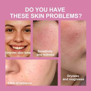 Vente en gros <span class=keywords><strong>Peach</strong></span> 70% Niacinamide Sérum 30ml Sérum Visage Hydratant Éclaircissant Peau terne et brillante Améliore la texture de la peau - Product Image 3