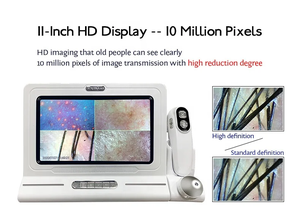 Analizador de Cuero Cabelludo Profesional, Microscopio Digital <span class=keywords><strong>para</strong></span> el Cabello, Sistema de Gestión del Cuero Cabelludo, Analizador de Cabello y Piel, Analizador de Folículos Pilosos - Product Image 2