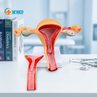 Precio al por mayor, estructura anatómica precisa de los órganos reproductivos internos para uso médico, modelo de útero femenino normal