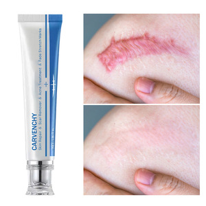 Gel <span class=keywords><strong>para</strong></span> el Acné, Crema <span class=keywords><strong>para</strong></span> <span class=keywords><strong>Cicatrices</strong></span>, Reparación <span class=keywords><strong>de</strong></span> <span class=keywords><strong>Quemaduras</strong></span>, Tratamiento Quirúrgico, Loción Facial con <span class=keywords><strong>Aloe</strong></span> <span class=keywords><strong>Vera</strong></span> y Vitamina C <span class=keywords><strong>para</strong></span> Todo Tipo <span class=keywords><strong>de</strong></span> Piel, 30 ml - Product Image 4