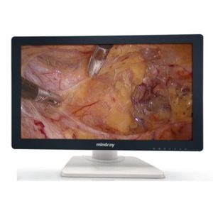 Système de caméra d'endoscopie médicale flexible Mindray HD3, endoscopie HD3 Full HD 1080p, caméra endoscopique portable pour usage animal - Product Image 6