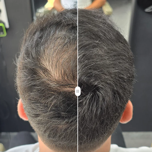 Liquide volumateur pour cheveux de barbier en baril de 50 kg, liquide de retouche pour cheveux imperméable pour hommes et femmes, cache-cheveux liquide, dure 5 à 7 jours - Product Image 5