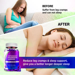 Gomitas de magnesio y potasio Citrato de magnesio Suplemento de gomitas masticables para calambres en las piernas y músculos - Product Image 3