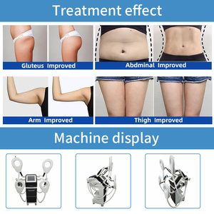 Tensity-4 mangos de medición, 4 unidades - Product Image 5