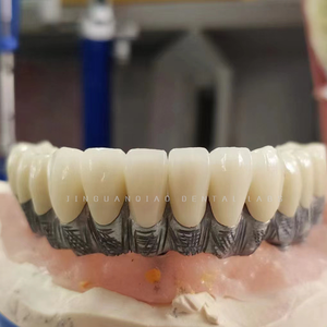 Ponte dentario contemporaneo dell'impianto ad arco pieno dentale a ponte di <span class=keywords><strong>Zirconia</strong></span> con qualità ottimale - Product Image 1