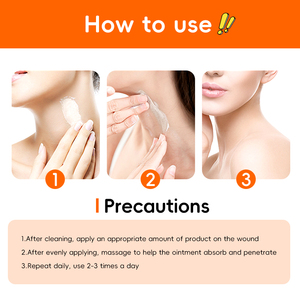 Crema inteligente para todo el acné, suministro sanitario universalmente efectivo que regula el equilibrio del aceite del agua, un verdadero <span class=keywords><strong>asesino</strong></span> del acné - Product Image 5