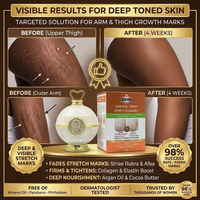 Crème de massage réduisant l'apparence des vergetures avec collagène, huile d'argan, booster d'élastine et beurre de cacao