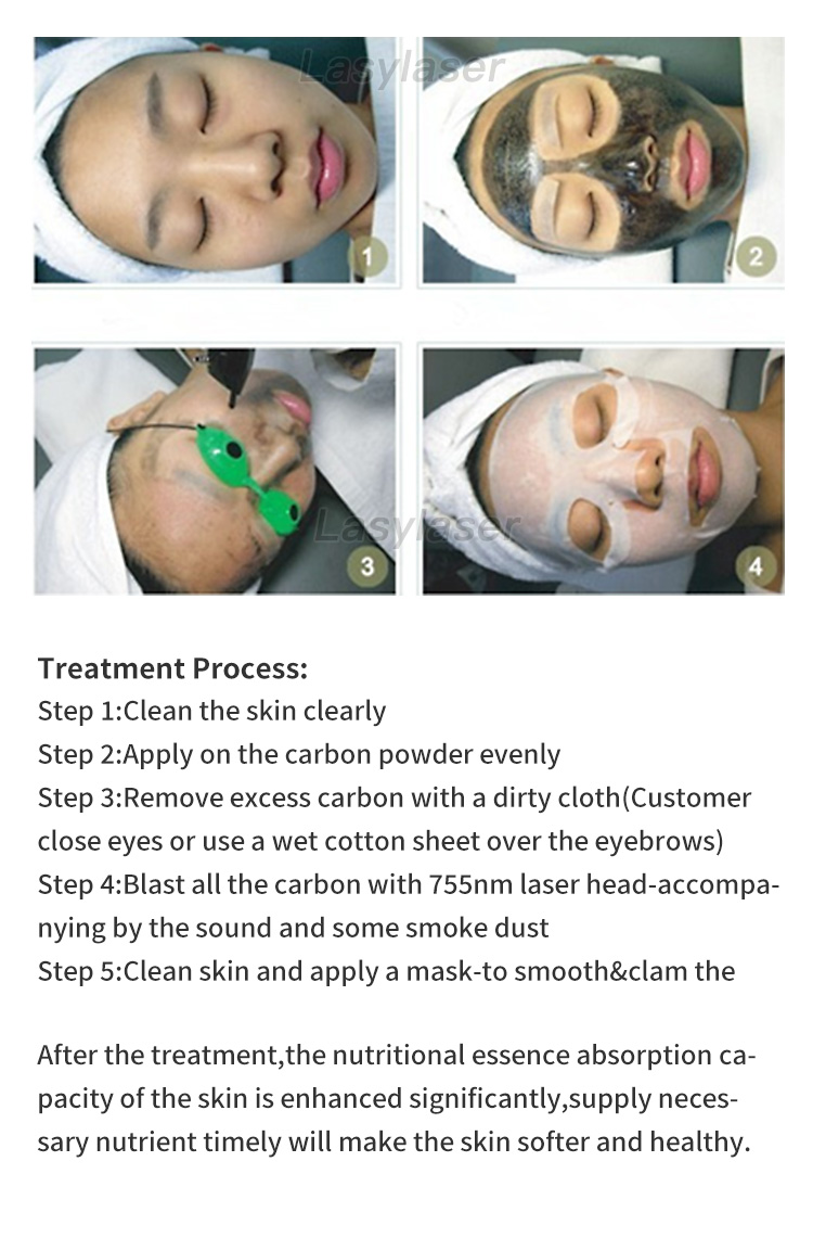 Nd:YAG picosecond laser instrument equipment to remove wrinkles and scars to lighten pores and improve acne