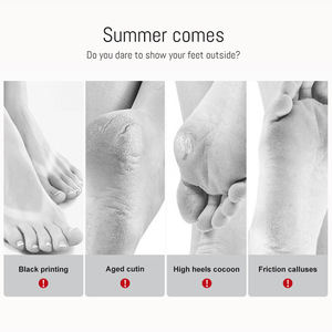 Nouveau masque pour les pieds à l'avocat, best-seller, pour améliorer la sécheresse, hydrater et réparer les pieds, vente en gros, exportation. - Product Image 3