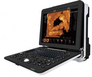 Échographe Doppler couleur, échographie Doppler/échographe Dawei 4D 5D - Product Image 3