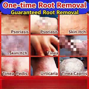 피부 발진을위한 천연 식물 추출물 가려움증 방지 크림 습진 곤충 물린 건조한 피부 자극 성인에게 적합 어린이 홈 - Product Image 2