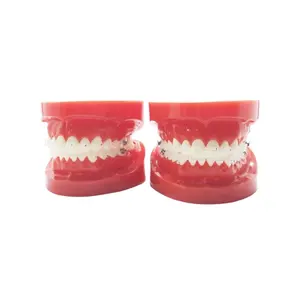 Denxy牙科正畸模型带陶瓷支架牙齿彩色线透明结扎红色正畸模型