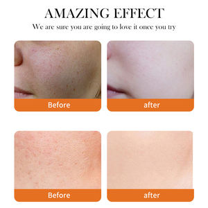 Meilleures ventes <span class=keywords><strong>Crème</strong></span> <span class=keywords><strong>pour</strong></span> le visage 50g Soin de la peau Anti-boutons Éclaircit <span class=keywords><strong>les</strong></span> taches brunes Curcuma Blanchissant - Product Image 4