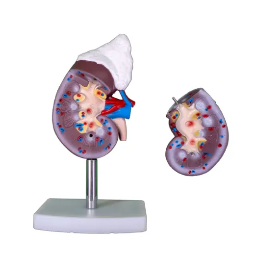 Detachable 2 Parts Human Kidney Anatomy Model For Medical School