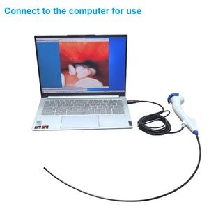 Offre Spéciale : Équipement Médical Réutilisable pour Ureteroscopie à Fibres Optiques Flexibles, Source de Lumière Portable, Endoscope pour Pyéloscopie et Diagnostic - Product Image 3
