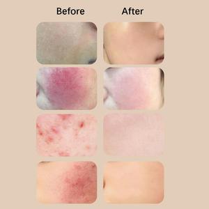 OEM Private Label Grass-Fed Beef Tallow <strong>Balm</strong> with Raw Honey - Moisturizing Cream for Soft, Smooth Skin - Product Image 6