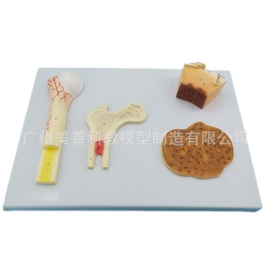 Modèle de structure osseuse : os épongeux, os compact, os Haver, cartilage périostal, modèle pédagogique orthopédique humain. - Product Image 2
