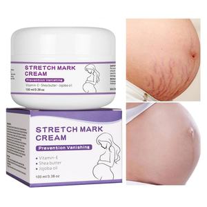 Autocollants personnalisés, crème anti-vergetures, soins de grossesse, produits pour femmes enceintes, produits de santé - Product Image 6