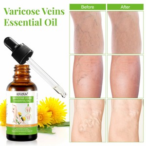 <span class=keywords><strong>Huile</strong></span> <span class=keywords><strong>Essentielle</strong></span> Veineuse <span class=keywords><strong>pour</strong></span> les <span class=keywords><strong>Varices</strong></span> et les Jambes Variquées 30 ml Durée de Conservation de 3 Ans - Product Image 3