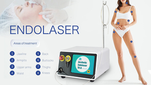 Láser Diodo de Lipólisis y Liposucción para Disolución de Grasa 980nm1470nm 47W, Estiramiento de la Piel, Lifting Facial con Láser Endo - Product Image 6