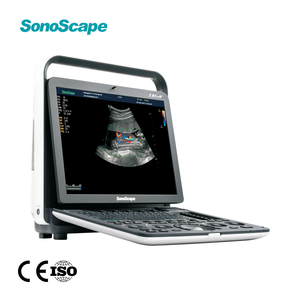 Ecógrafo Doppler Color Digital Portátil y Duradero Sonoscape S8 ExpV, Escáner Veterinario para Clínica y <span class=keywords><strong>Hospital</strong></span> - Product Image 1