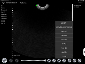 Alta Qualidade 192 Elementos Handheld Cor <span class=keywords><strong>Doppler</strong></span> Wifi & Usb Ultrassom <span class=keywords><strong>Transvaginal</strong></span> <span class=keywords><strong>Probe</strong></span> Konted C10QT - Product Image 3