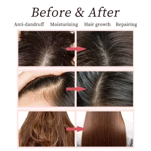 Sulfate Free Private Label Vegan Organic Tea Tree Anti Dandruff Repair Argan Oil Natural Rice Water Biotin Hair Growth Shampoo