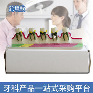 Modelo Anatómico de Caries Dental de Resina, Modelo de Exhibición de Decadencia Dental con Sellador de Fisuras, Modelo de Clasificación Periodontal - Product Image 4