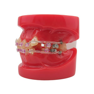 Modelo de Demostración de Ortodoncia Dental con 24 Piezas de Brackets de Cerámica - Product Image 2