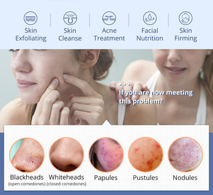 Appareil de Soin de la Peau 2025 pour le Rajeunissement Cutané, l'Élimination des Rides, le Raffermissement de la Peau, le Traitement de l'Acné par Marteau Froid, Appareil de Beauté - Product Image 5