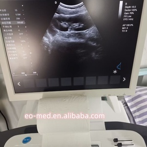 เครื่องอัลตราซาวนด์เคลื่อนที่อเนกประสงค์แบบพกพา รุ่น TC29 พร้อมระบบสีดอปเปลอร์ สำหรับการวินิจฉัยโรค - Product Image 5