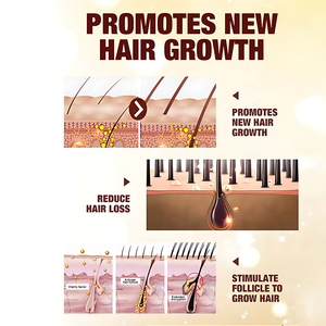 Champú de Aloe Vera Orgánico de Marca Blanca, Fortalece, Densifica, Nutre, Aumenta <span class=keywords><strong>el</strong></span> Volumen, Suaviza, Combate la Caspa y la Caída del Cabello - Product Image 3