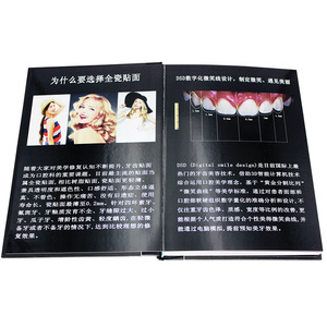 Catálogo de Carillas Dentales de Porcelana: Demostración del Proceso de Colocación de Carillas Dentales de Porcelana, Exhibición de Efectos, Calidad y - Product Image 3