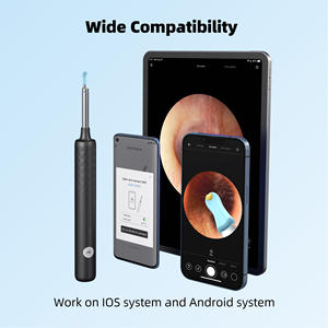 <span class=keywords><strong>Pour</strong></span> R1 – Nettoyeur d'<span class=keywords><strong>oreilles</strong></span> intelligent sans fil Wi-Fi 3MP avec batterie au lithium et caméra, en alliage d'aluminium, <span class=keywords><strong>pour</strong></span> un nettoyage visuel médical du cérumen - Product Image 6