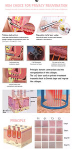 Máquina de Láser Fraccional de CO2 de 10600nm en Oferta, Tubo de 60W para Eliminación de Cicatrices, Equipo de Belleza Multifuncional Seguro para Salón de Belleza - Product Image 5