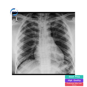 Taşınabilir düz Panel dedektör tıbbi hayvan X ışını makinesi ile hastane veteriner dijital mobil x-ray sistemi - Product Image 6