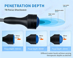 Dispositivo de Fisioterapia con Ondas de Choque Enfocadas, Máquina Profesional de Terapia Física con Ondas de Choque para la Disfunción Eréctil - Product Image 3