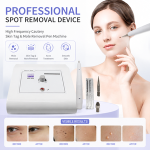 Dispositivo Profesional de Eliminación de <span class=keywords><strong>Verrugas</strong></span>, Cauterizador de Alta Frecuencia, Pluma para Eliminar <span class=keywords><strong>Verrugas</strong></span> y Lunares, para Salón de Belleza - Product Image 1